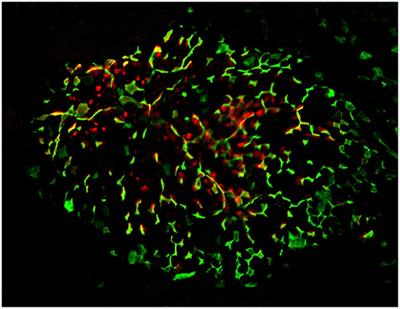 M Cells: Intelligent Engineering of Mucosal Immune Surveillance